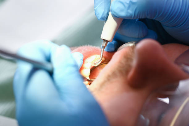 Best Urgent Tooth Repair  in East Farmingdale, NY